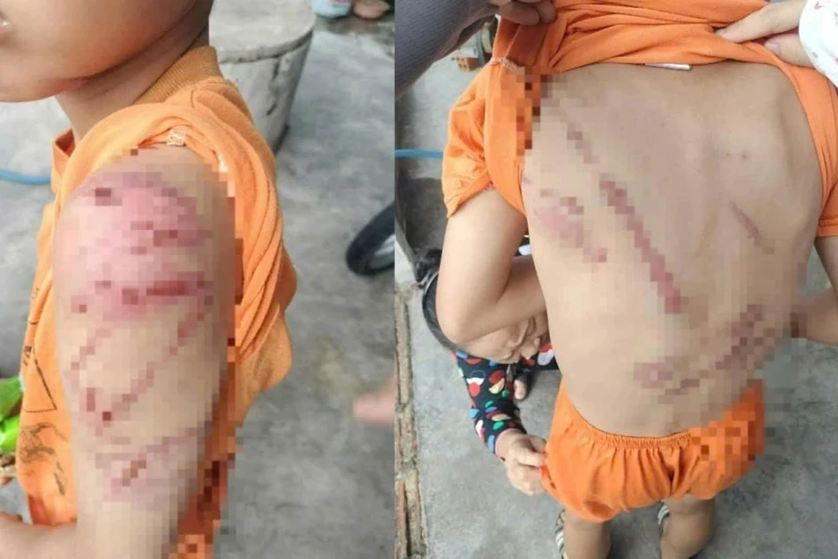 Công an thông tin vụ bé trai 10 tuổi bị bố đánh chi chít vết thương Công an thông tin vụ bé trai 10 tuổi bị bố đánh chi chít vết thương