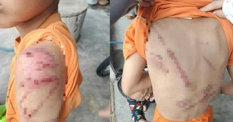 Công an thông tin vụ bé trai 10 tuổi bị bố đánh chi chít vết thương