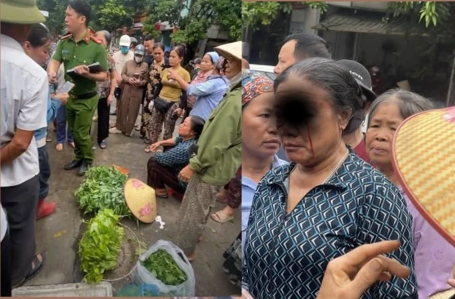 Công an xác minh việc người phụ nữ bán rau bị thương do nước xịt vào mặt Công an xác minh việc người phụ nữ bán rau bị thương do nước xịt vào mặt