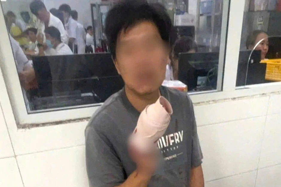 CSGT Cần Thơ kịp thời hỗ trợ người đàn ông bị đứt rời 4 ngón tay CSGT Cần Thơ kịp thời hỗ trợ người đàn ông bị đứt rời 4 ngón tay