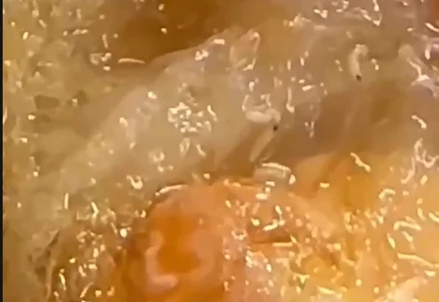 Dòi bò lúc nhúc trong hộp xôi mua tại tiệm bánh mì ở Quảng Trị Dòi bò lúc nhúc trong hộp xôi mua tại tiệm bánh mì ở Quảng Trị