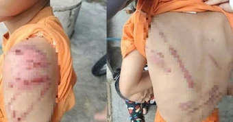Dùng roi mây đánh con trai bầm tím cơ thể, người cha bị phạt 7,5 triệu đồng