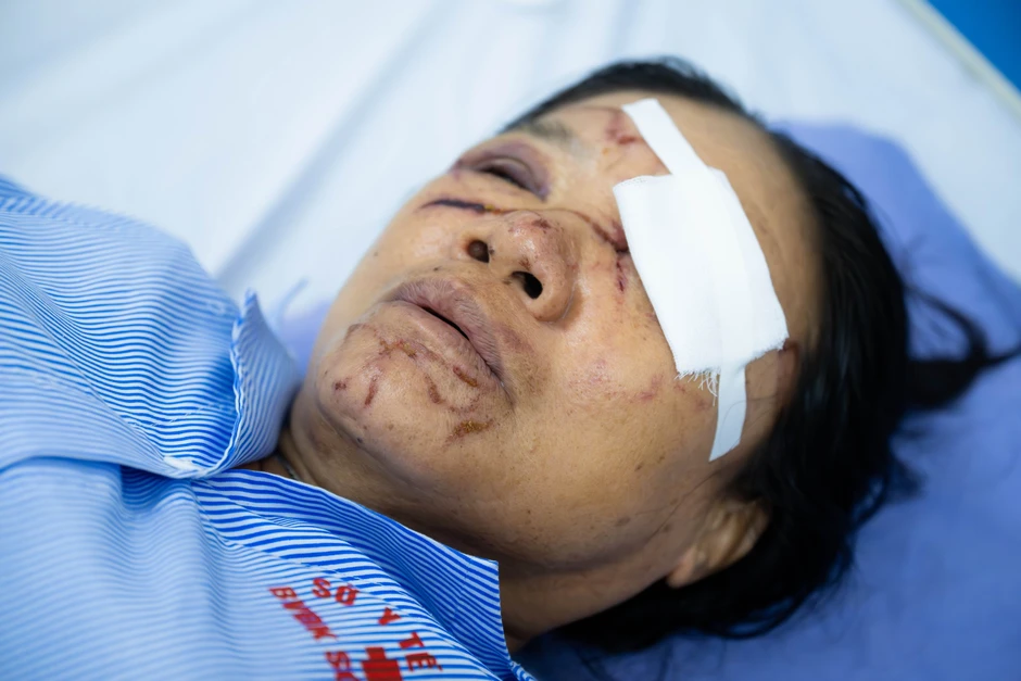 Gặp người phụ nữ bán rau bị xịt nước chảy máu mắt ở Phú Thọ: "Nước xối vào mạnh lắm, đau rát, tối mắt tối mũi" Gặp người phụ nữ bán rau bị xịt nước chảy máu mắt ở Phú Thọ: "Nước xối vào mạnh lắm, đau rát, tối mắt tối mũi"