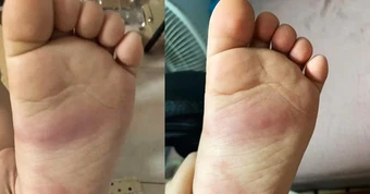 Hưng Yên xác minh vụ bạo hành trẻ em tại trường mầm non An Vinh