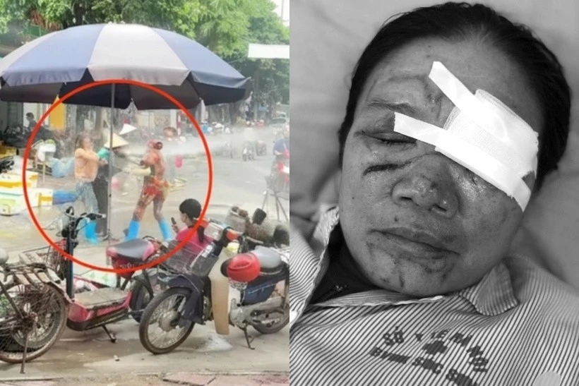 Liên tiếp xảy ra vụ xịt vòi nước cao áp vào người khác, luật sư nói gì? Liên tiếp xảy ra vụ xịt vòi nước cao áp vào người khác, luật sư nói gì?