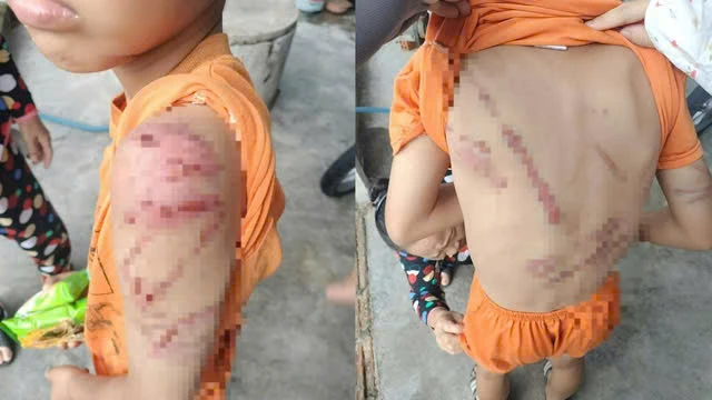 Lý do người cha đánh con 10 tuổi bầm tím khắp người Lý do người cha đánh con 10 tuổi bầm tím khắp người