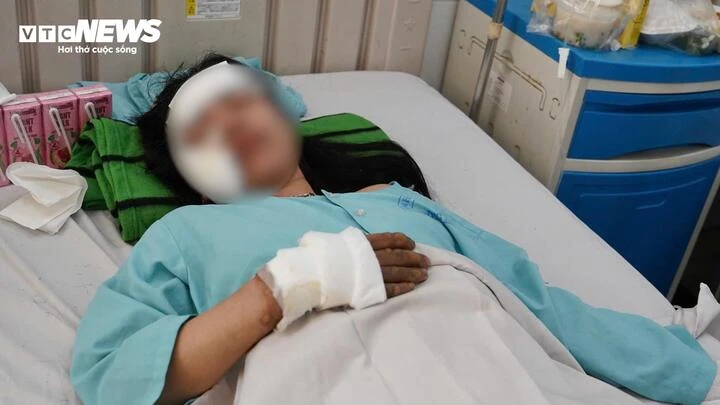 Nạn nhân sống sót vụ cháy xe khách ở Đồng Nai kể lại khoảnh khắc kinh hoàng Nạn nhân sống sót vụ cháy xe khách ở Đồng Nai kể lại khoảnh khắc kinh hoàng