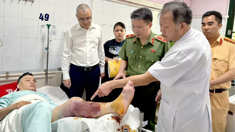 Tạm giữ hình sự thanh niên vi phạm nồng độ cồn, lái xe tông CSGT gãy chân Tạm giữ hình sự thanh niên vi phạm nồng độ cồn, lái xe tông CSGT gãy chân