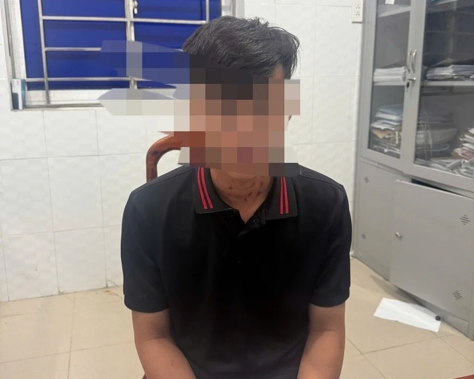 Tây Ninh: Truy tìm nhóm thanh niên hành hung người đi đường vì tiếng nẹt pô Tây Ninh: Truy tìm nhóm thanh niên hành hung người đi đường vì tiếng nẹt pô