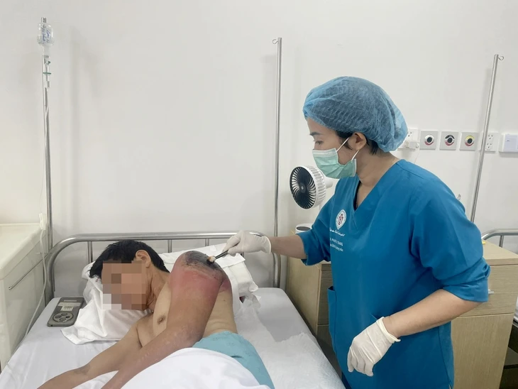 Cẩn trọng những ‘mẹo dân gian’ biến vết thương nhẹ thành nhiễm trùng nặng Cẩn trọng những ‘mẹo dân gian’ biến vết thương nhẹ thành nhiễm trùng nặng