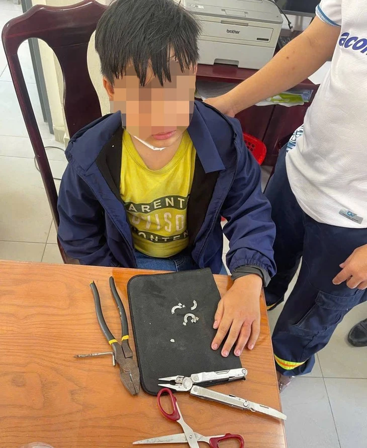 Nghịch đeo nhiều vòng kim loại, học sinh lớp 6 phải nhờ cảnh sát 'giải cứu' Nghịch đeo nhiều vòng kim loại, học sinh lớp 6 phải nhờ cảnh sát 'giải cứu'