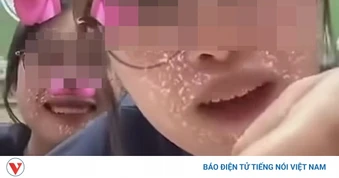 2 nữ sinh dọa "tiêm thuốc độc" trên mạng: Bệnh viện Đức Giang lên tiếng