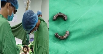 Bác sĩ tại Cần Thơ dùng máy cắt cứu người đàn ông ở An Giang gặp nạn vì “nâng cấp dương vật"