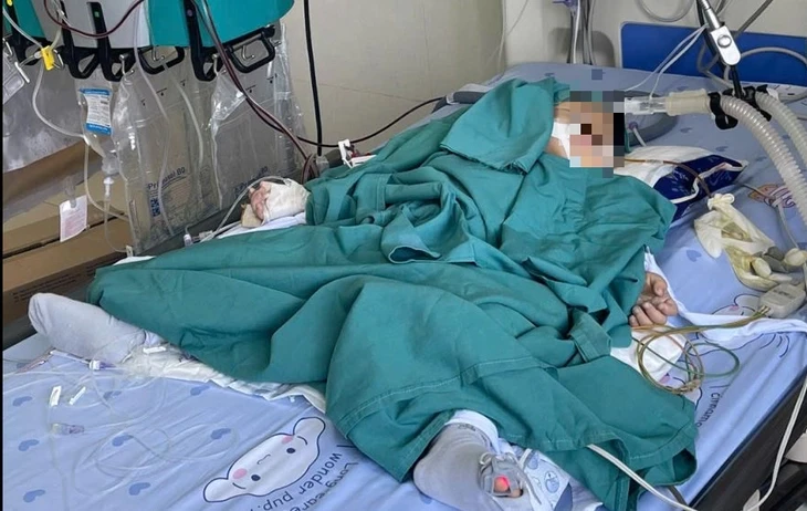 Bé 2 tuổi ngộ độc nặng sau khi nuốt vật màu xanh anh trai mang từ trường về