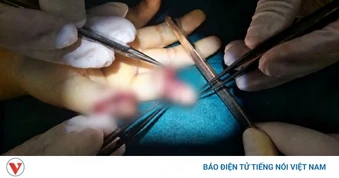 Bé trai 5 tuổi đứt lìa 2 ngón tay khi chơi xe điện tự chế