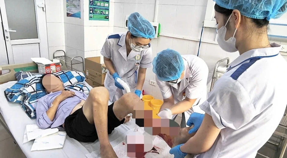 Biến chứng hoại tử nguy kịch: Sai lầm trong xử lý vết thương tại nhà