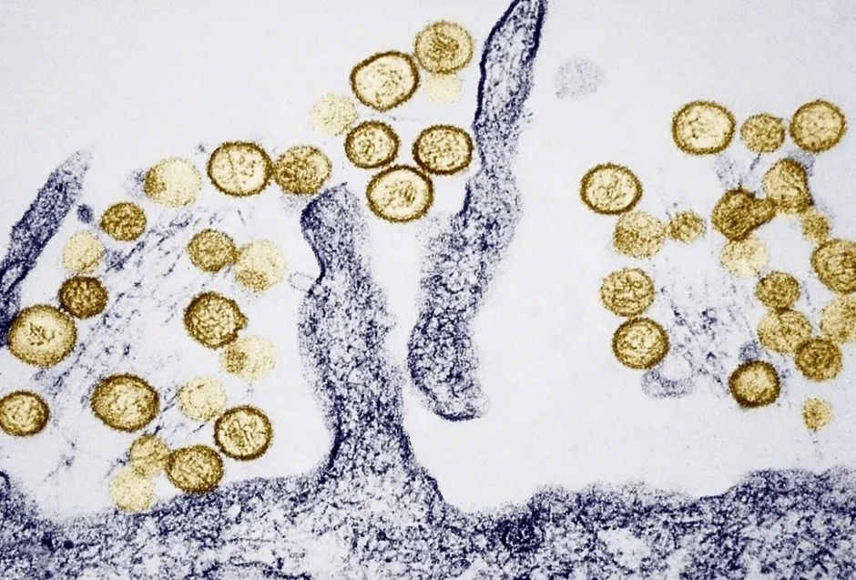 Bộ Y tế cảnh báo khẩn virus Hanta lây truyền từ chuột Bộ Y tế cảnh báo khẩn virus Hanta lây truyền từ chuột