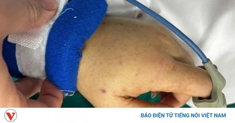 Cà Mau ghi nhận 3 ca nghi mắc bệnh viêm não mô cầu