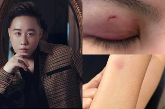 Ca sĩ Trung Quân Idol bị tố hành hung phụ nữ: Luật sư nói gì về trách nhiệm pháp lý?