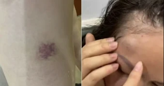 Điều tra vụ một gia đình tố bị hàng xóm liên tục đe dọa, hành hung