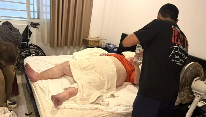 Du khách nặng gần 300 kg mắc kẹt trong nhà vệ sinh ở Đà Nẵng
