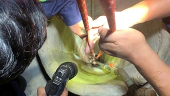 Gia Lai: Kịp thời cứu nạn cô gái rơi xuống giếng sâu