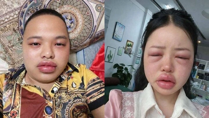 Giới trẻ "phát cuồng" món bánh trứng kiến nhưng không phải ai cũng nên ăn Giới trẻ "phát cuồng" món bánh trứng kiến nhưng không phải ai cũng nên ăn
