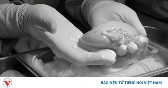 Hành trình 2 năm “tái sinh sự sống” cho bệnh nhân suy thận vùng ĐBSCL
