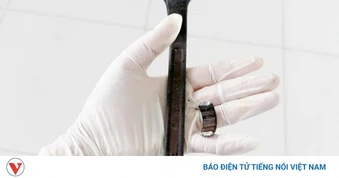 Hy hữu bệnh nhân bị mắc kẹt “của quý” trong cờ lê sắt