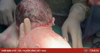 Khoảnh khắc đẹp tuần qua (23-29/3): “Đôi cánh nhỏ” và hành trình giữ lại sự sống