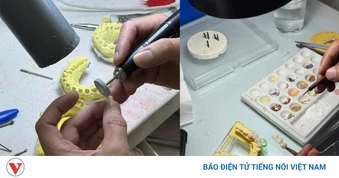 Kiểm tra răng giả tại Hà Nội: Gần 45% cơ sở vi phạm, 1 vụ chuyển công an