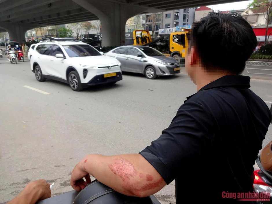 Lại xảy ra vụ ô tô húc văng dải phân cách cứng trên đường Phạm Văn Đồng Lại xảy ra vụ ô tô húc văng dải phân cách cứng trên đường Phạm Văn Đồng