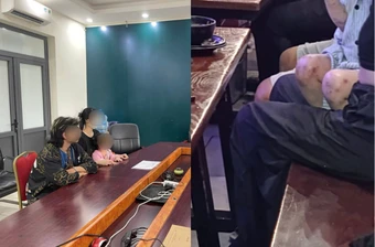 Mẹ đưa con gái đến quán bia tại Hà Nội lý giải thế nào về các vết thâm trên chân, nghi bị bạo hành?