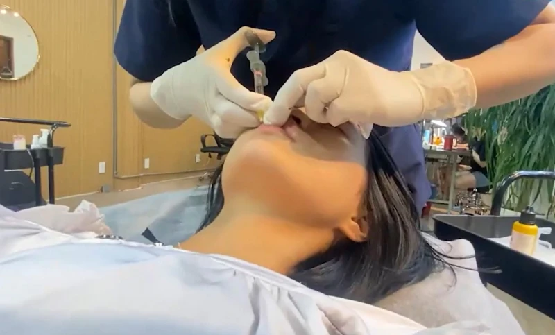 Một cơ sở “thẩm mỹ chui” tiêm filler gây biến chứng Một cơ sở “thẩm mỹ chui” tiêm filler gây biến chứng