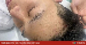 Nam sinh nhập viện sau vụ bị hành hung trong đêm ở Hà Nội