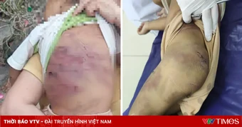 Nóng trên mạng tuần qua (4-10/5): Tâm điểm nhiều vụ bạo hành trẻ em