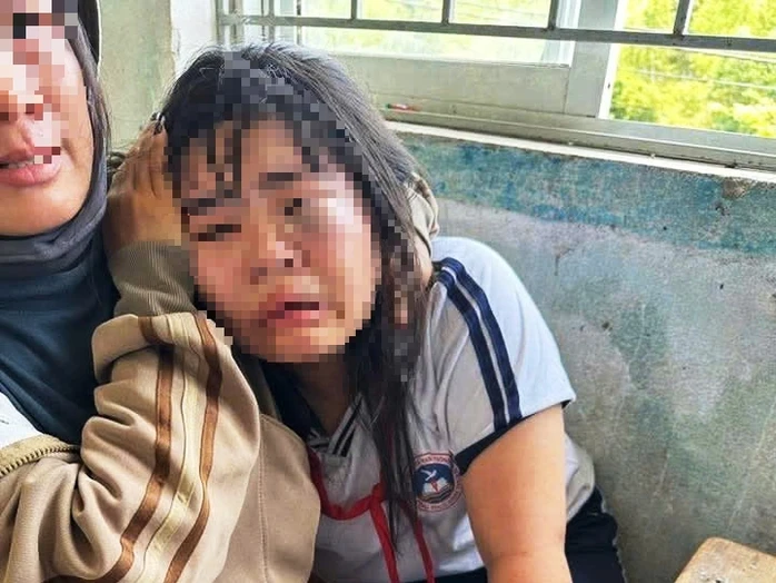 Nữ sinh lớp 7 bị 2 nam sinh lớp 9 đánh nhập viện Nữ sinh lớp 7 bị 2 nam sinh lớp 9 đánh nhập viện