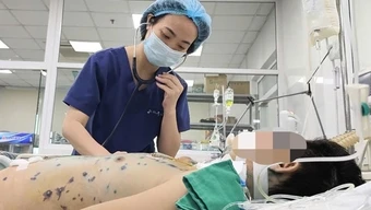 Thuỷ đậu tấn công người lớn, nhiều người nguy kịch