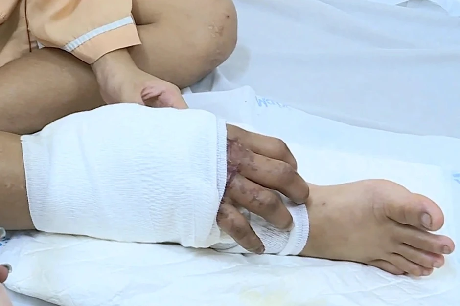 Từng gây chấn động với ca ghép bàn tay đứt lìa vào chân khi đang mang song thai, cuộc sống hiện tại của người mẹ đơn thân giờ ra sao? Từng gây chấn động với ca ghép bàn tay đứt lìa vào chân khi đang mang song thai, cuộc sống hiện tại của người mẹ đơn thân giờ ra sao?