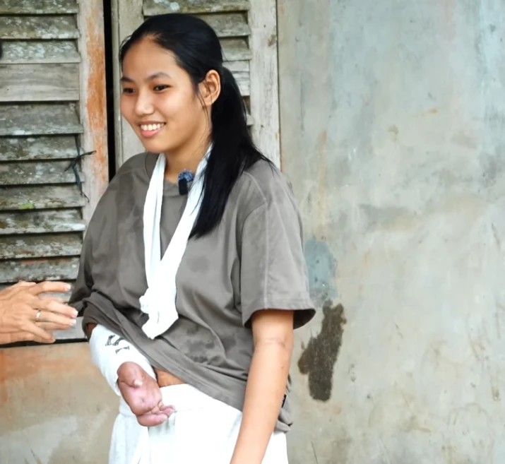 Từng gây chấn động với ca ghép bàn tay đứt lìa vào chân khi đang mang song thai, cuộc sống hiện tại của người mẹ đơn thân giờ ra sao? Từng gây chấn động với ca ghép bàn tay đứt lìa vào chân khi đang mang song thai, cuộc sống hiện tại của người mẹ đơn thân giờ ra sao?