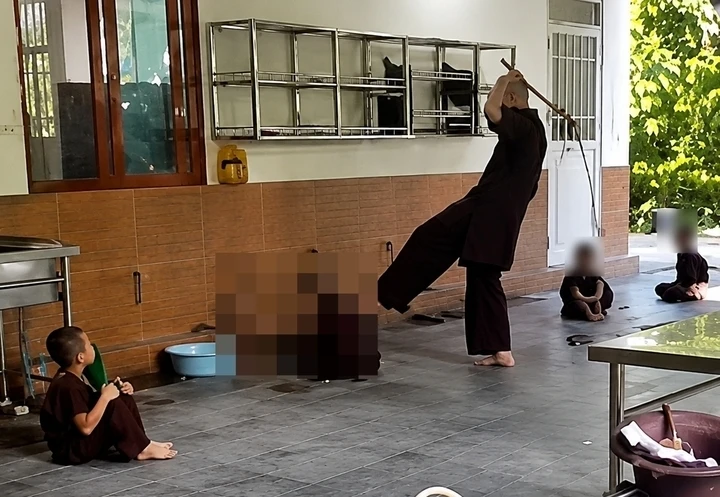 Vụ 5 chú tiểu ở chùa Bầu bị đánh gây thương tích: Bộ Y tế vào cuộc Vụ 5 chú tiểu ở chùa Bầu bị đánh gây thương tích: Bộ Y tế vào cuộc