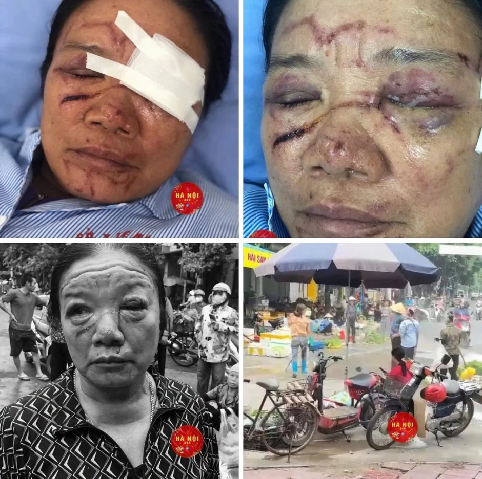 Vụ bà bán rau bị xịt nước chảy máu mắt: Cơ quan chức năng Phú Thọ vào cuộc Vụ bà bán rau bị xịt nước chảy máu mắt: Cơ quan chức năng Phú Thọ vào cuộc
